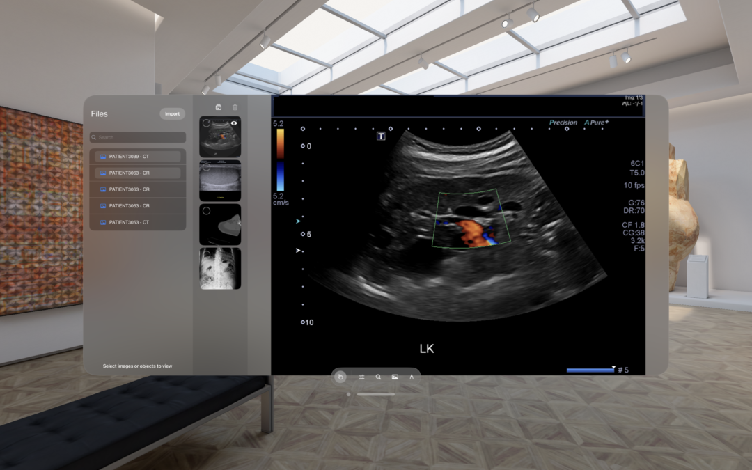 Luxsonic Technologies Unveils Luxsonic Spatial: A Revolutionary DICOM Viewer for Apple Vision Pro